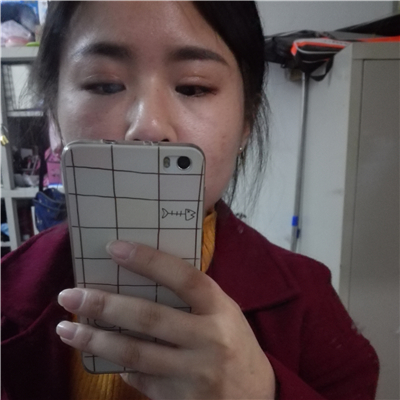 注射瘦臉去魚尾紋恢復(fù)過程和前后對(duì)比果圖片分享，上海東方做的~