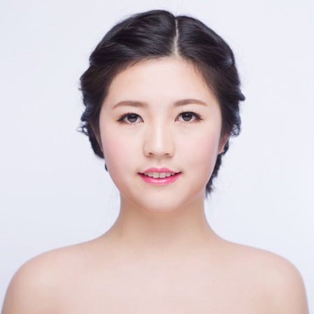 激光去雀斑前后對(duì)比果圖片分享，福州海峽林瓏醫(yī)生做的~