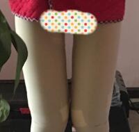 今年去做了大腿吸脂減肥手術(shù)，吸脂果挺好的