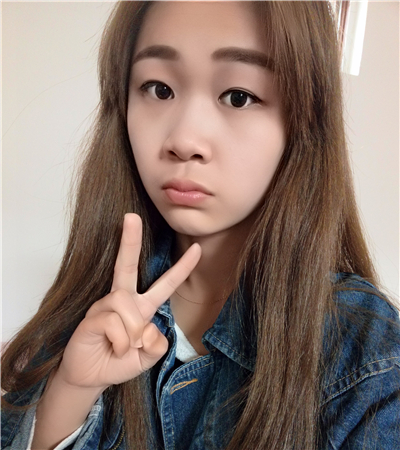 開內(nèi)眼角+切開雙眼皮前后對比果圖片分享，青島金島韓勝醫(yī)生做的~