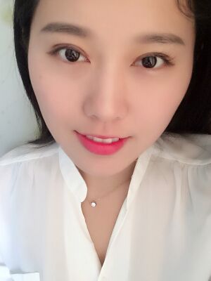 雙眼皮失敗修復手術(shù)恢復超自然，看起來一點都不假