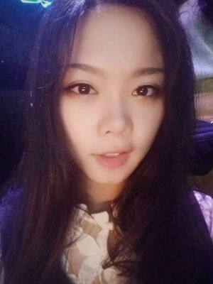 全切雙眼皮手術(shù)，送給自己的成年禮物