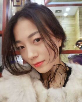 激光去眼袋成好嗎，看看我就知道啦