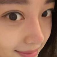 為什么大家覺得隆鼻恐怖，我就做了玻尿酸隆鼻，過程經(jīng)歷分享