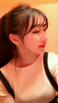 顴骨整形手術(shù)后，我也可以擁有精致小臉了
