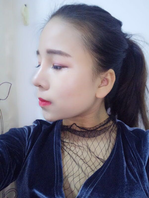 廣州廣美做的假體隆鼻，給大家分享一下手術(shù)前后過(guò)程以及對(duì)比照片