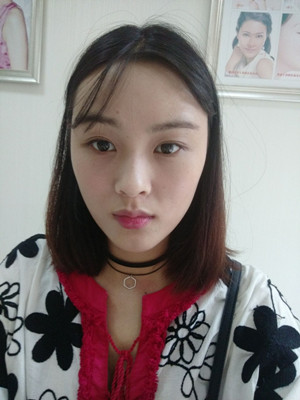 自體脂肪填充全臉，我也可以美美噠
