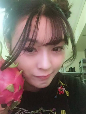 自體脂肪填充全臉，我也可以美美噠