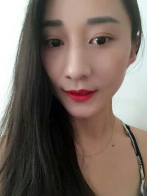 激光祛斑前后對比圖，雀斑全都沒啦