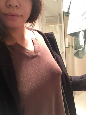 大家看看自體脂肪隆胸恢復果圖吧