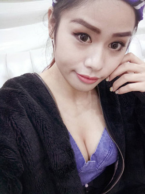大家看看自體脂肪隆胸恢復果圖吧