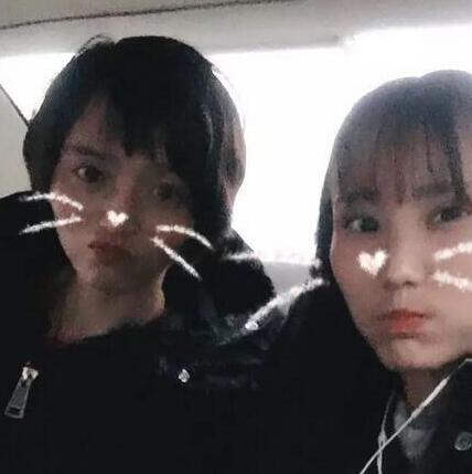牙齒矯正的真實(shí)過(guò)程，現(xiàn)在我終于可以露出牙齒放聲大笑了