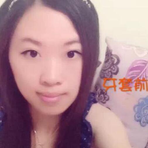 牙齒矯正前后對(duì)比照真實(shí)過程分享終于不是齙牙妹了哦