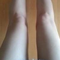 水動力吸脂減肥瘦大腿真實經(jīng)歷，抽脂后對比照片分享