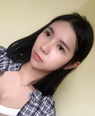 自體脂肪填充恢復(fù)日志 自體脂肪填充太陽(yáng)穴+額頭