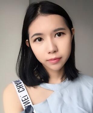 自體脂肪填充恢復(fù)日志 自體脂肪填充太陽(yáng)穴+額頭