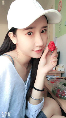 56000元做的自體脂肪填充蘋果肌+太陽穴，大家來看看果怎么樣