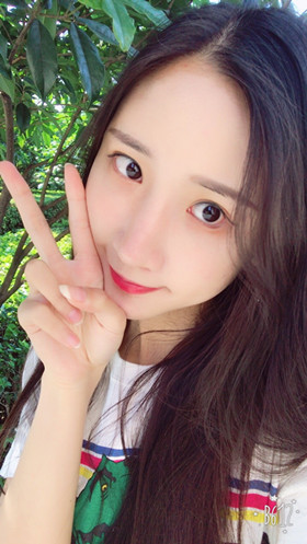 56000元做的自體脂肪填充蘋果肌+太陽穴，大家來看看果怎么樣