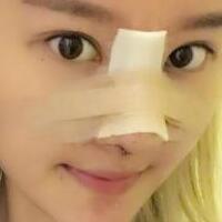 硅膠假體隆鼻過程和隆鼻前后圖片，真實(shí)案例分享