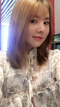 歪鼻矯正+假體隆鼻前后手術過程圖片分享