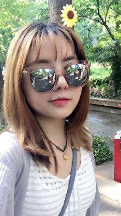 歪鼻矯正+假體隆鼻前后手術過程圖片分享