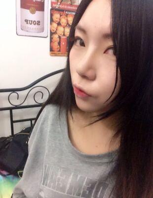 隆鼻整形真實恢復期圖片 硅膠隆鼻+鼻頭縮小