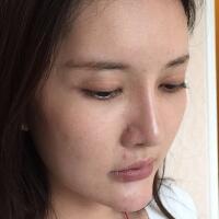 面部面b提升恢復日記和恢復圖片，一周左右恢復自然