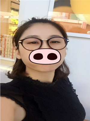 注射瘦臉去眉間紋真實案例分享——?？诩t妝李科醫(yī)生做的