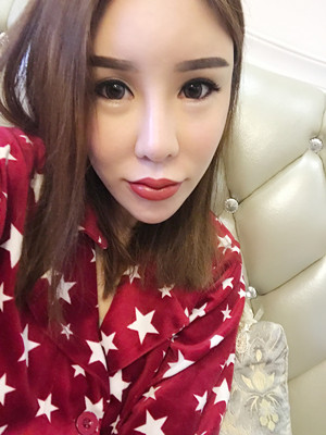 高強度聚焦超聲手術(shù)三個月的前后恢復(fù)記錄——?？诩t妝李科做的