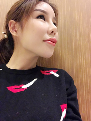 高強度聚焦超聲手術(shù)三個月的前后恢復(fù)記錄——?？诩t妝李科做的