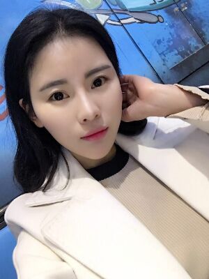 自體脂肪填充全臉經(jīng)歷，臉型超**的