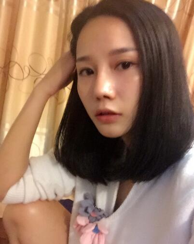 隆鼻整形真實(shí)恢經(jīng)歷 曬圖啦！