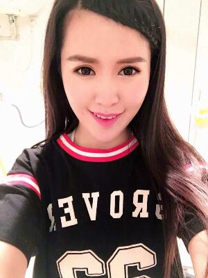 全切雙眼皮修復(fù)恢復(fù)后圖片，寬度較為合適喲