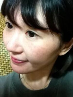 激光去雀斑果好不好，真實(shí)案例告訴你