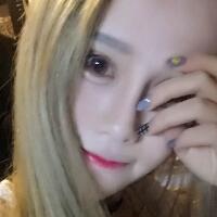 玻尿酸填充臥蠶果對比圖，很滿意