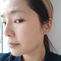 做完光子嫩膚恢復(fù)圖片和過(guò)程分享，光子嫩膚價(jià)格3800元