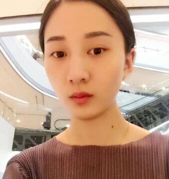 有誰做過激光祛雀斑？個人激光祛雀斑后恢復日記分享