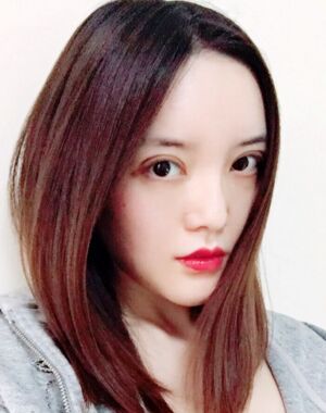全切雙眼皮+硅膠墊下巴真實(shí)案例對比圖