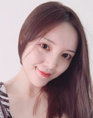 全切雙眼皮+硅膠墊下巴真實(shí)案例對比圖