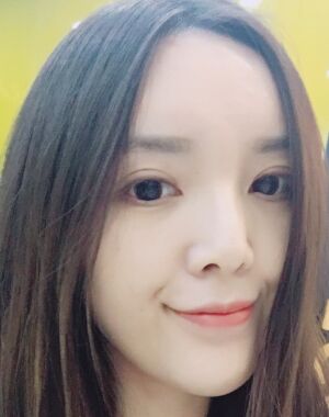 全切雙眼皮+硅膠墊下巴真實(shí)案例對比圖
