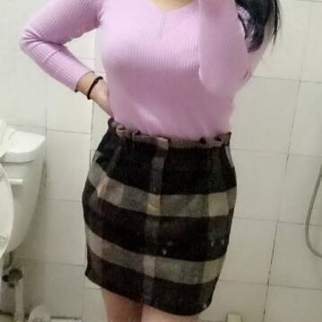 吸脂減肥瘦腰腹不反彈,恢復(fù)過程圖分享