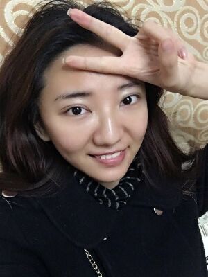 激光祛痘恢復(fù)過(guò)程圖，福州愛(ài)美爾做的喲
