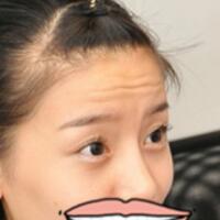 注射瘦臉去抬頭紋果不錯(cuò)——濟(jì)南吉芙美容整形醫(yī)院