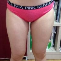 抽脂減肥瘦大腿價格10800元，一個月后恢復(fù)很好