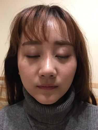 上海潔銘線D提升三個月后的圖片