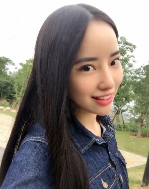 貴陽美萊梁潔隆鼻整形兩個月果圖
