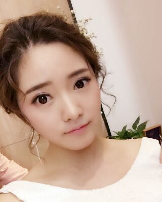 全切微創(chuàng)雙眼皮恢復(fù)圖，長(zhǎng)沙希美蔣松林手術(shù)案例