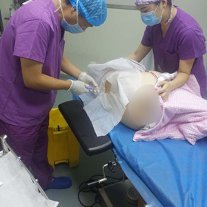 青?？等A馮相周醫(yī)生大腿抽脂案例分享