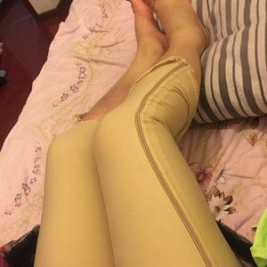 青?？等A馮相周醫(yī)生大腿抽脂案例分享