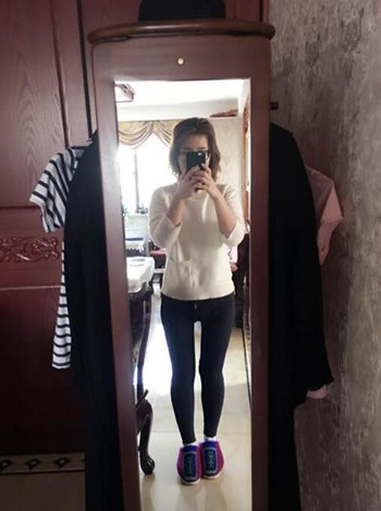 廣州美萊羅延平做的大腿環(huán)吸整形恢復果過程案例